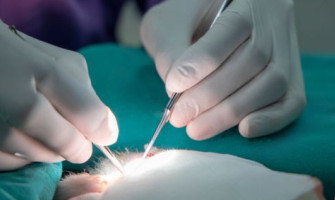 Microsurgery in Dentistry